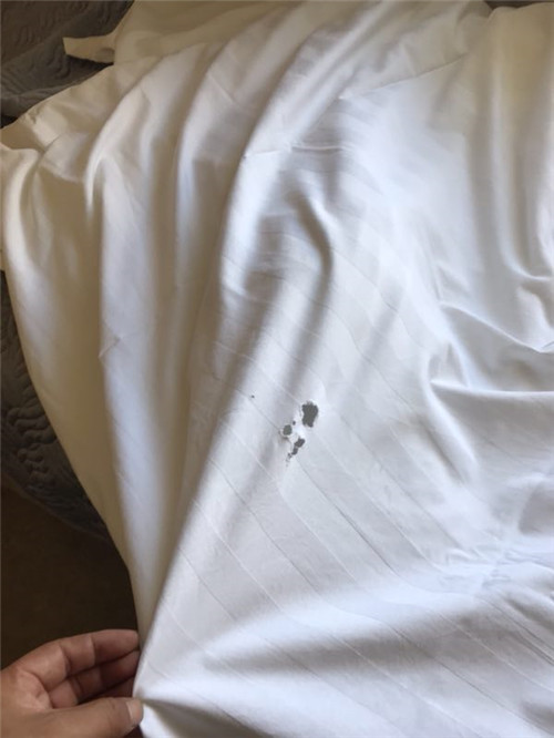 \
